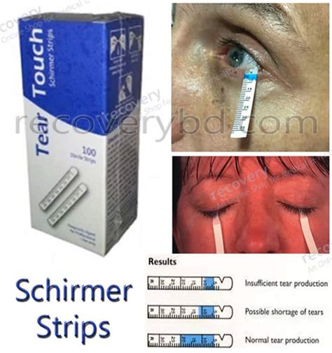 4 tear test|schirmer test without anesthesia.